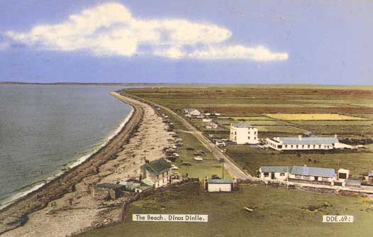 The Beach, Dinas Dinlle